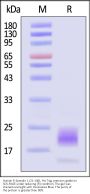 Human R-Spondin 1 / RSPO1 (21-146) Protein, His Tag, premium grade