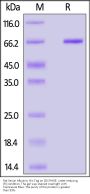 Rat Serum Albumin Protein, His Tag (MALS & SPR verified)