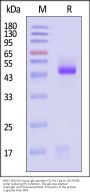 HRSV (B) Post-fusion glycoprotein F0, His Tag (MALS verified)