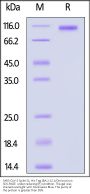 SARS-CoV-2 Spike S1 Protein, His Tag (BA.2.12.1/Omicron)