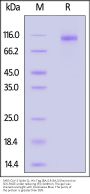 SARS-CoV-2 Spike S1 Protein, His Tag (BA.4 & BA.5/Omicron)