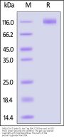 SARS-CoV-2 Spike S1 Protein, His Tag (BA.2.75/Omicron)