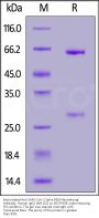Biotinylated Anti-SARS-CoV-2 Spike RBD Neutralizing Antibody, Chimeric mAb, Human IgG1 (AM122) (MALS verified)