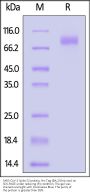SARS-CoV-2 Spike S2 protein, His Tag (BA.2/Omicron)