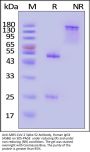 Anti-SARS-CoV-2 Spike S2 Antibody, Human IgG4 (AS86)