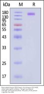 Biotinylated Human SEZ6 Protein, His,Avitag™ (MALS verified)