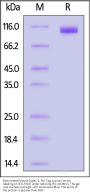 Biotinylated Mouse Siglec-2 / CD22 Protein, His Tag, ultra sensitivity (primary amine labeling) (MALS verified)