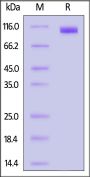Biotinylated Mouse Siglec-2 / CD22 Protein, His Tag, ultra sensitivity (primary amine labeling) (MALS verified)