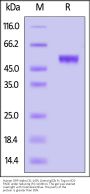Human SIRP alpha / CD172a (31-149) Protein, Llama IgG2b Fc Tag, low endotoxin (MALS verified)