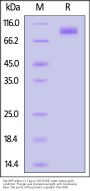 Rat SIRP alpha / CD172a Protein, Fc Tag (MALS verified)