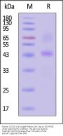 Human SLC2A1 Full Length Protein, His Tag (Detergent)