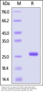 Human SLIT2 Protein, His Tag