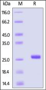 Human SLIT2 Protein, His Tag