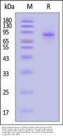 Biotinylated Human SLITRK6 protein, His,Avitag™
