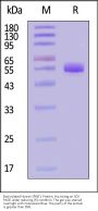 Biotinylated Human SPINT1 Protein, His,Avitag™ (MALS verified)