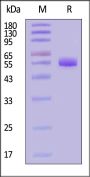 Biotinylated Human SPINT1 Protein, His,Avitag™ (MALS verified)