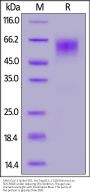 SARS-CoV-2 Spike NTD Protein, His Tag (B.1.1.529/Omicron) (MALS verified)