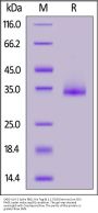 SARS-CoV-2 Spike RBD Protein, His Tag (B.1.1.529/Omicron) (MALS verified)