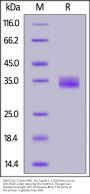 SARS-CoV-2 Spike RBD Protein, His Tag (B.1.1.529/Omicron) (Trehalose free) (MALS verified)