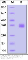SARS-CoV-2 Spike RBD Protein, His Tag (BA.4&BA.5/Omicron) (MALS verified)