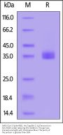 SARS-CoV-2 Spike RBD Protein, His Tag (BA.2.11/Omicron) (MALS verified)