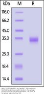 SARS-CoV-2 Spike RBD Protein, His Tag (BA.2.75/Omicron) (MALS verified)