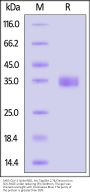 SARS-CoV-2 Spike RBD Protein, His Tag (BA.2.74/Omicron) (MALS verified)