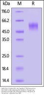 SARS-CoV-2 Spike NTD Protein, His Tag (BA.2.75/Omicron) (MALS verified)