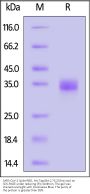 SARS-CoV-2 Spike RBD Protein, His Tag (BA.2.75.2/Omicron) (MALS verified)