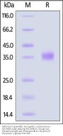 SARS-CoV-2 Spike RBD Protein, His Tag (BQ.1.1/Omicron) (MALS verified)