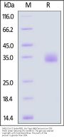 SARS-CoV-2 Spike RBD Protein, His Tag (XBB/Omicron) (MALS verified)