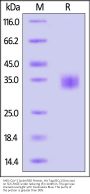 SARS-CoV-2 Spike RBD Protein, His Tag (BQ.1/Omicron) (MALS verified)