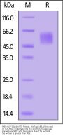 SARS-CoV-2 Spike NTD Protein, His Tag (XBB.1/Omicron) (MALS verified)
