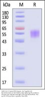 SARS-CoV-2 Spike NTD Protein, His Tag (BA.4 & BA.5/Omicron) (MALS verified)