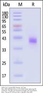 SARS-CoV-2 Spike RBD Protein, His Tag (BA.2.86/V483del/USA) (MALS verified)