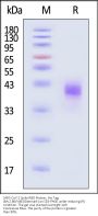 SARS-CoV-2 Spike RBD Protein, His Tag (BA.2.86/V483/Denmark) (MALS verified)