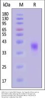 SARS-CoV-2 Spike RBD Protein, His Tag (JN.1/Omicron) (MALS verified)