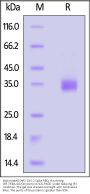 Biotinylated SARS-CoV-2 Spike RBD Protein, His,Avitag™ (BF.7&BA.4.6/Omicron) (MALS verified)