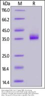 Biotinylated SARS-CoV-2 Spike RBD Protein, His,Avitag™ (B.1.1.529/Omicron) (MALS verified)