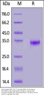 Biotinylated SARS-CoV-2 (COVID-19) S protein RBD, His,Avitag™ (MALS verified)