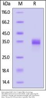 Biotinylated SARS-CoV-2 Spike RBD Protein, His,Avitag™ (BA.4&BA.5/Omicron) (MALS verified)