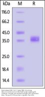 Biotinylated SARS-CoV-2 Spike RBD Protein, His,Avitag™ (BA.2.12.1/Omicron) (MALS verified)