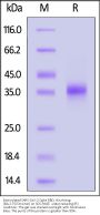 Biotinylated SARS-CoV-2 Spike RBD Protein, His,Avitag™ (BA.2.75/Omicron) (MALS verified)