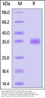 Biotinylated SARS-CoV-2 Spike RBD Protein, His,Avitag™ (BA.2.76/Omicron) (MALS verified)
