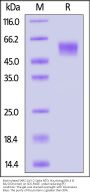 Biotinylated SARS-CoV-2 Spike NTD Protein, His,Avitag™ (BA.4 & BA.5/Omicron) (MALS verified)