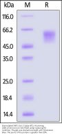 Biotinylated SARS-CoV-2 Spike NTD Protein, His,Avitag™ (XBB.1/Omicron) (MALS verified)
