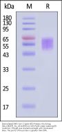 Biotinylated SARS-CoV-2 Spike NTD Protein, His,Avitag™ (BA.2.86/Denmark/EPI_ISL_18114953) (MALS verified)