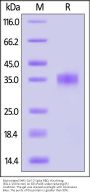 Biotinylated SARS-CoV-2 Spike RBD Protein, His,Avitag™ (BQ.1.1/Omicron) (MALS verified)