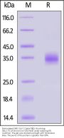 Biotinylated SARS-CoV-2 Spike RBD Protein, His,Avitag™ (BA.2.75.2/Omicron) (MALS verified)