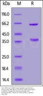 Anti-SARS-CoV-2 RBD Potent Neutralizing Antibody, Human IgG1 (AM180)